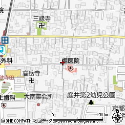 京都府城陽市寺田（中大小）周辺の地図